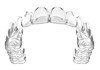 Aligneurs clairs