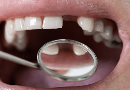 dent-abente-section-2-min(1)
