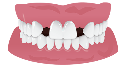 dent-absente-section-3-min(1)