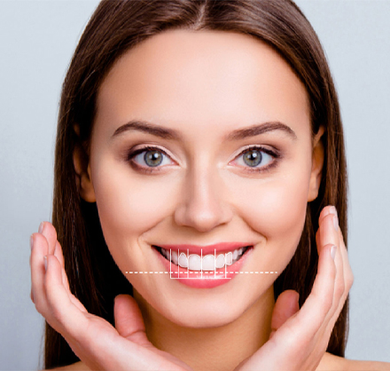 imperfection-du-sourire-section-3